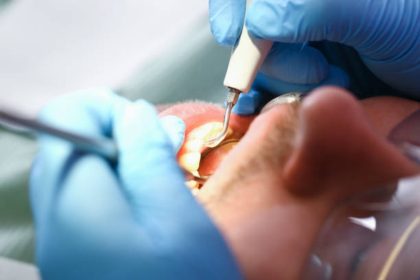 Best Broken or Chipped Tooth Repair in Bayboro, NC