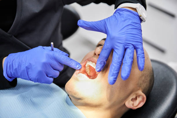 Best Knocked-Out Tooth (Avulsed Tooth) Treatment in Bayboro, NC
